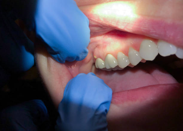 Best Urgent Care for Lost Fillings or Crowns in USA